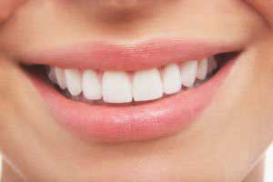 1425683203381 - سفید کردن دندان در مدت کوتاه